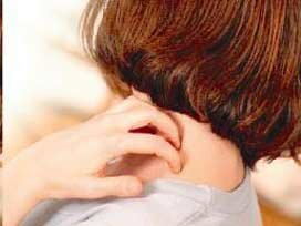 kaşıntı nedenleri ve tedavisi