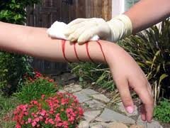 hemofili bitkisel tedavi