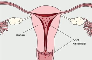 adet söktürücü bitkiler