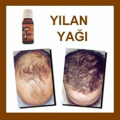 sac dokulmesine yilan yagi